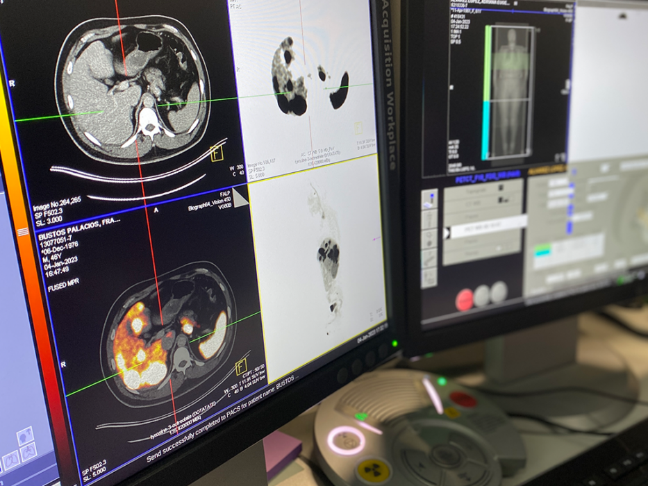 PET-CT - Fundación Arturo López Pérez